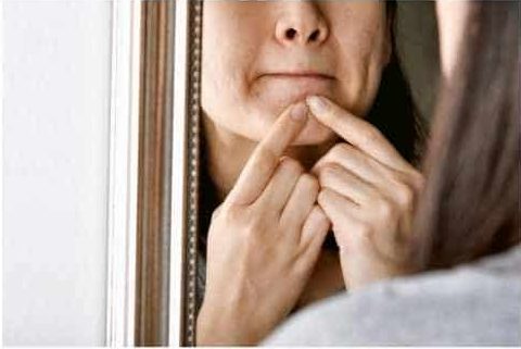 woman picking the skin on her chin