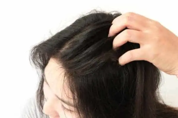 woman with scalp dermatillomania