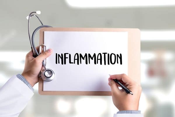 doctor holding clipboard that says 'inflammation'