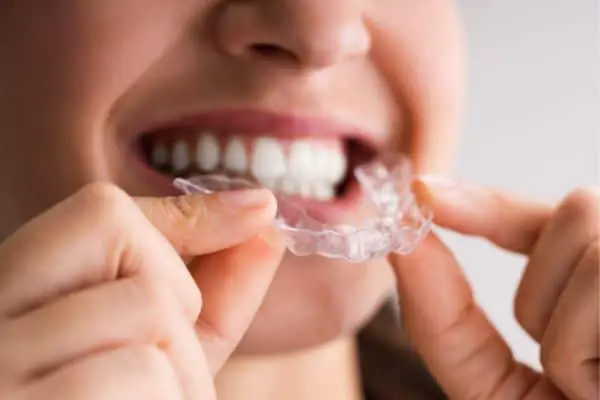 Woman putting in a mouth guard